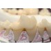 AcrylX Xthetic TEMP Tooth Shade Acrylic STARTER KIT (1-608-01) - Crown and Bridge High Grade - Colour Stable - 1 KIT