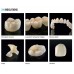 Detax Freeprint CROWN (Permanent Crowns, Denture Teeth, Long Term Temp Bridges) 385 DLP 3D Printing Resin - 500g and 1000g