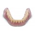 Kulzer DIMA Print Resin - Denture Base 1000g - Shade Options Available